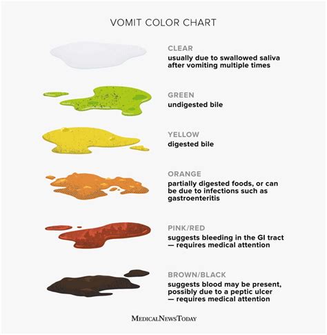 bile vomit color chart